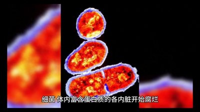 ​科普|女尸腐烂的原因及处理方法