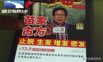 ​尴尬！男子坚持使用“苗家生发秘方”，5个月后头发全没了